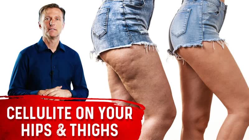 How To Get Rid Of Cellulite On Thighs