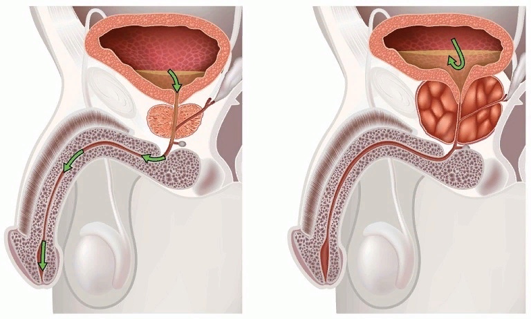 Features, signs, diagnosis and treatment