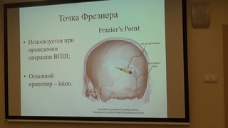 Горяйнов С.А. Декомпрессивная трепанация черепа в лечении ЧМТ.