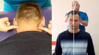 У многих людей схожая родовая травма шеи, из-за которой может болеть спина и другие перекосы по телу