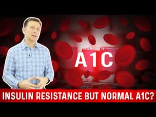Normal A1C But Why Do I have Insulin Resistance  Dr. Berg